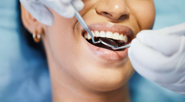 Best Urgent Tooth Repair  in Somers, MT